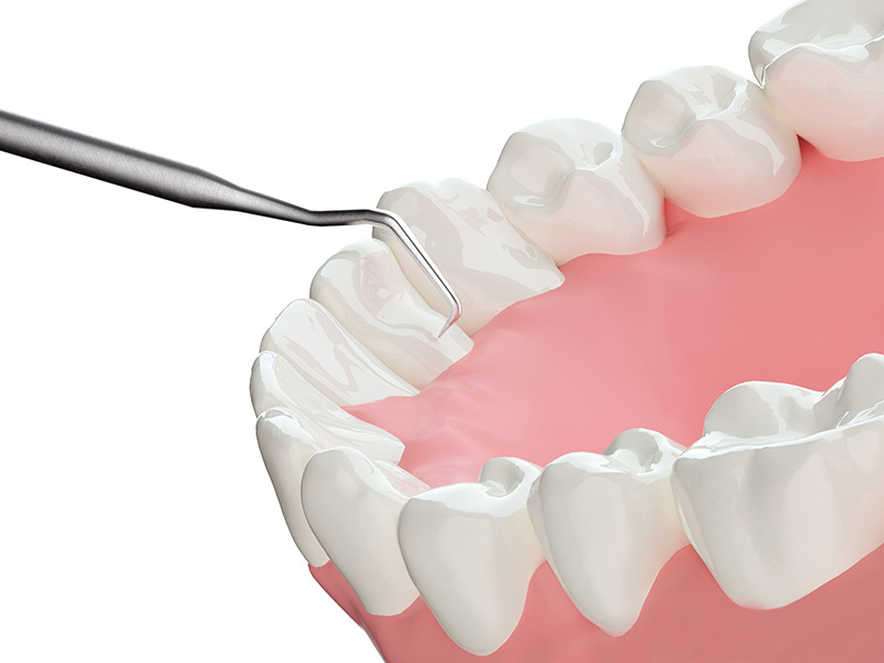 画像をアップロード