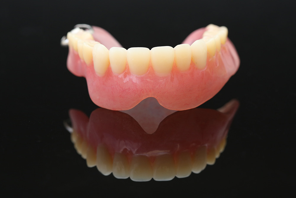 総入れ歯（総義歯）