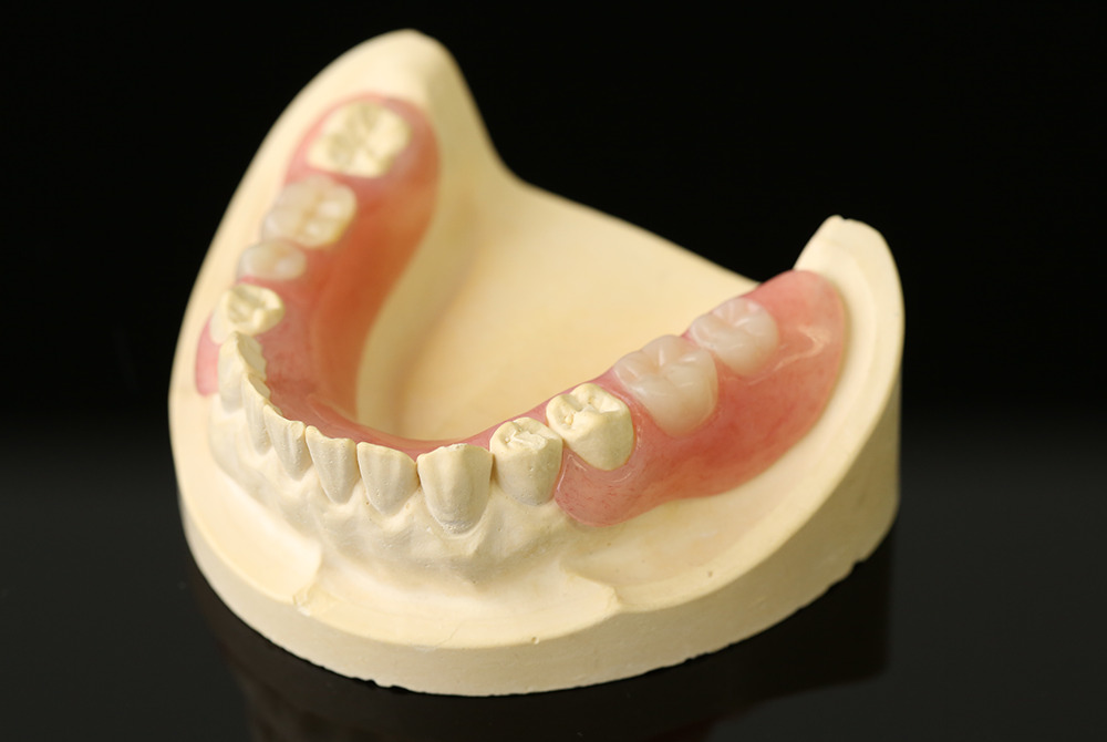 ノンクラス・プデンチャー