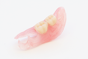 ノンクラスプ・デンチャー