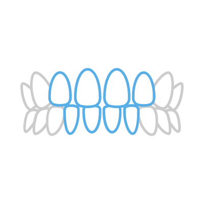 すきっ歯（空隙歯列）