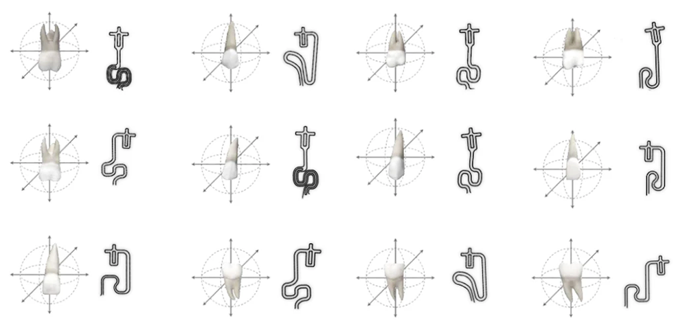 ブラーバのカスタムアームの種類