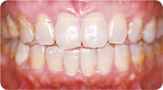 取り外しができるから衛生的