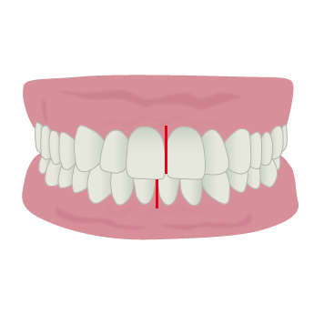 中心がずれている