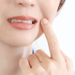 歯がきになる女性