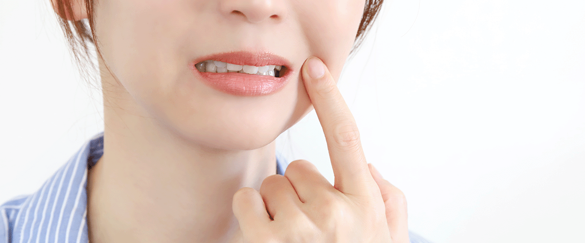 ホワイトスポットが気になる女性